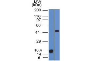 Western Blot of recombinant Adipophilin and Jurkat cell lysate using Adipophilin Mouse Monoclonal Antibody (ADFP/1365). (ADRP 抗体  (AA 249-376))
