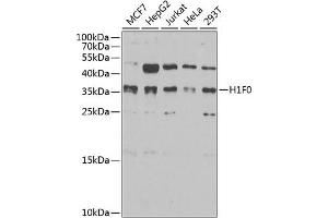 Western blot analysis of extracts of various cell lines, using Histone H1. (Histone H1 抗体  (AA 1-194))