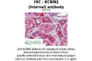Image no. 1 for anti-Potassium Intermediate/small Conductance Calcium-Activated Channel, Subfamily N, Member 2 (KCNN2) (AA 545-557), (Internal Region) antibody (ABIN1736194) (KCNN2 抗体  (Internal Region))