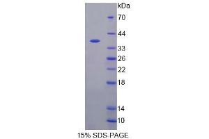 SDS-PAGE (SDS) image for Cytochrome P450, Family 17, Subfamily A, Polypeptide 1 (CYP17A1) (AA 201-507) protein (His tag) (ABIN6239972)