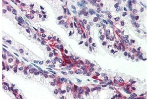 Anti-SLC39A6 antibody  ABIN1049338 IHC staining of human prostate. (SLC39A6 抗体  (Internal Region))
