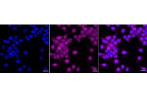 Immunocytochemical staining of HeLa cells with P70 S6 Kinase beta antibody (ABIN7800226), 1:1,000). (Recombinant RPS6KB2 抗体)