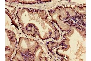 Immunohistochemistry of paraffin-embedded human prostate tissue using ABIN7159300 at dilution of 1:100 (MIA 抗体  (AA 87-124))