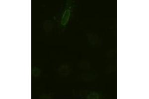 Anti-IL-6 mouse monoclonal antibody (ABIN2452353) immunofluorescent staining of HeLa cells transiently transfected by pCMV6-ENTRY IL-6 (RC202078) (IL-6 抗体  (AA 29-212))