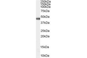 Western Blotting (WB) image for anti-Aldehyde Dehydrogenase 16 Family, Member A1 (ALDH16A1) (N-Term) antibody (ABIN2790717) (ALDH16A1 抗体  (N-Term))