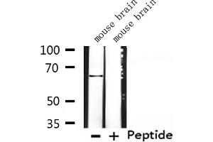 Western blot analysis of extracts from mouse brain, using K2C3 Antibody. (Keratin 3 抗体  (C-Term))