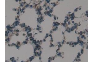Detection of SP-B in Rat Lung Tissue using Polyclonal Antibody to Surfactant Protein B (SP-B) (SFTPB 抗体  (AA 111-352))