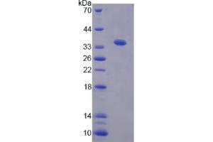 Image no. 1 for Tsukushin (TSKU) (AA 30-307) protein (His tag) (ABIN6238462)