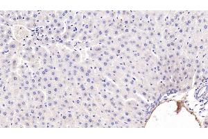 Immunohistochemistry (IHC) image for anti-Adiponectin (ADIPOQ) (AA 111-244) antibody (ABIN7427417)