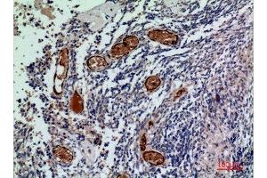 Immunohistochemistry (IHC) image for anti-Rh Family A Glycoprotein (RHAG) (N-Term) antibody (ABIN3181013)