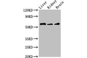 Western Blot Positive WB detected in: Mouse liver tissue, Mouse kidney tissue, Mouse brain tissue All lanes: CHRM5 antibody at 3. (CHRM5 抗体  (AA 220-427))