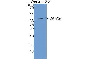 Detection of Recombinant TH, Rat using Polyclonal Antibody to Tyrosine Hydroxylase (TH) (Tyrosine Hydroxylase 抗体  (AA 34-301))