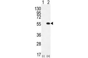 Western blot analysis of PRMT2 antibody and 293 cell lysate either nontransfected (Lane 1) or transiently transfected (2) with the PRMT2 gene. (PRMT2 抗体  (AA 344-375))