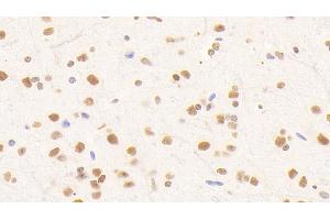 Immunohistochemistry (IHC) image for anti-Nucleoporin 88kDa (NUP88) (AA 57-296) antibody (ABIN7441823)