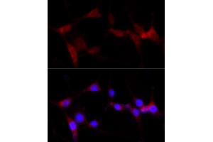 Immunofluorescence (IF) image for anti-Cytochrome P450, Family 1, Subfamily B, Polypeptide 1 (CYP1B1) (AA 1-260) antibody (ABIN3021931)