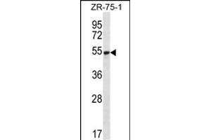 SEC62 Antibody (N-term) (ABIN656777 and ABIN2845996) western blot analysis in ZR-75-1 cell line lysates (35 μg/lane). (SEC62 抗体  (N-Term))