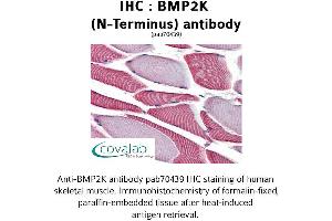 Image no. 2 for anti-BMP2 Inducible Kinase (BMP2K) (N-Term) antibody (ABIN1732361) (BMP2K 抗体  (N-Term))