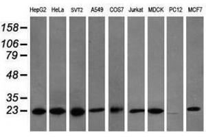 Image no. 6 for anti-Prefoldin Subunit 3 (PFDN3) antibody (ABIN1501707) (VBP1 抗体)