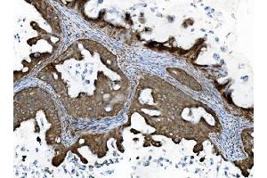 IHC analysis of INPPL1 using anti-INPPL1 antibody (ABIN7599785).