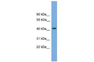 Western Blot showing PALM antibody used at a concentration of 1-2 ug/ml to detect its target protein. (Paralemmin 抗体  (N-Term))
