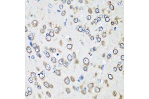 Immunohistochemistry of paraffin-embedded rat brain using EEF1G antibody. (EEF1G 抗体  (AA 168-437))