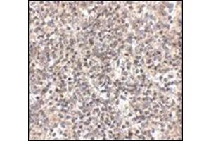Immunohistochemistry of RSPO1 in human spleen tissue with this product at 2. (RSPO1 抗体  (N-Term))