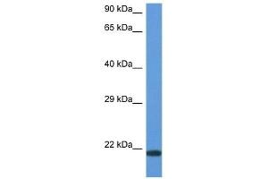 Western Blot showing CD70 antibody used at a concentration of 1 ug/ml against ACHN Cell Lysate