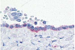 Human Ovary: Formalin-Fixed, Paraffin-Embedded (FFPE) (ENPP3 抗体  (Internal Region))