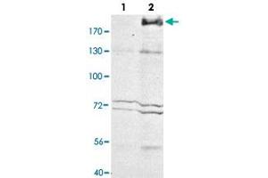 Western blot analysis of Mrc1 in whole cell extracts. (Macrophage Mannose Receptor 1 抗体)