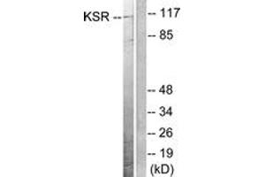 Western blot analysis of extracts from NIH-3T3 cells, treated with PDGF 50ng/ml 20', using KSR (Ab-392) Antibody. (KSR1 抗体  (AA 358-407))