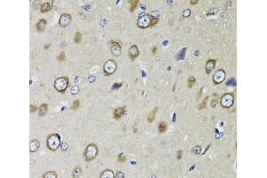 Immunohistochemistry of paraffin-embedded Rat brain using RPS10 Polyclonal Antibody at dilution of 1:100 (40x lens). (RPS10 抗体)
