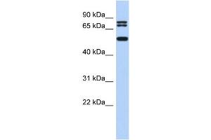 WB Suggested Anti-LASS4 Antibody Titration:  0. (LASS4 抗体  (N-Term))