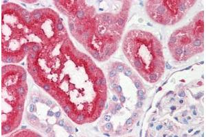 Immunohistochemistry (IHC) image for anti-Solute Carrier Family 6 (Neurotransmitter Transporter, Dopamine), Member 3 (SLC6A3) (EL2 Region) antibody (ABIN1104350)
