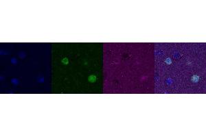 Immunohistochemistry (IHC) image for anti-Calbindin (CALB1) antibody (ABIN7456109) (CALB1 抗体)