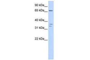 Image no. 1 for anti-IQ Motif Containing E (IQCE) (AA 288-337) antibody (ABIN6741340) (IQCE 抗体  (AA 288-337))