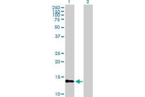 Western Blot analysis of PTS expression in transfected 293T cell line by PTS MaxPab polyclonal antibody.