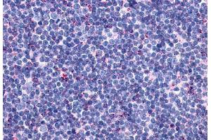 Anti-CCR10 antibody  ABIN1048387 IHC staining of human thymus. (CCR10 抗体  (Extracellular Domain))