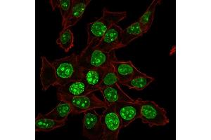Confocal Immunofluorescence of HeLa cells Ki67 Mouse Monoclonal Antibody (MKI67/2465). (Ki-67 抗体  (AA 2293-2478))
