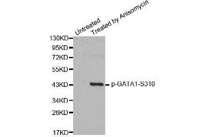 Western blot analysis of extracts from HT29 cells, using Phospho-GATA1-S310 antibody (ABIN2988025).
