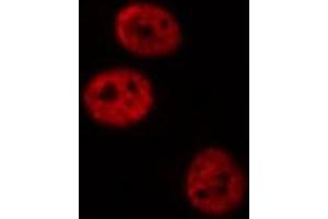 ABIN6277420 staining NIH-3T3 cells by IF/ICC. (PAWR 抗体  (C-Term))