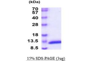 SDS-PAGE (SDS) image for Calcium/calmodulin-Dependent Protein Kinase II Inhibitor 1 (CAMK2N1) (AA 1-78) protein (His tag) (ABIN7281227)