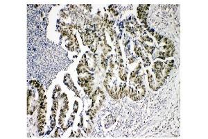 IHC analysis of KDM5B using anti-KDM5B antibody (ABIN4886648).
