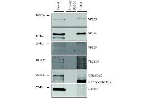 Immunoprecipitation analysis using Mouse Anti-VPS35 Monoclonal Antibody, Clone 10A8 (ABIN6932982). (VPS35 抗体  (Atto 488))