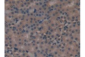 Immunohistochemistry (IHC) image for anti-ATP-Binding Cassette, Sub-Family C (CFTR/MRP), Member 1 (ABCC1) (AA 1219-1469) antibody (ABIN7440026)