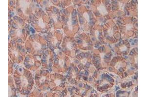 IHC-P analysis of Mouse Stomach Tissue, with DAB staining. (IL11RA 抗体  (AA 194-329))