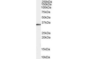 Western Blotting (WB) image for anti-STIP1 Homology and U-Box Containing Protein 1 (STUB1) (C-Term) antibody (ABIN184697)