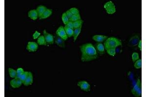 Immunofluorescent analysis of PC-3 cells using ABIN7149438 at dilution of 1:100 and Alexa Fluor 488-congugated AffiniPure Goat Anti-Rabbit IgG(H+L) (PHGDH 抗体  (AA 2-251))