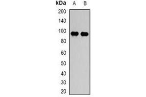 Western blot analysis of STAT5B expression in HepG2 (A), PC12 (B) whole cell lysates. (STAT5B 抗体)