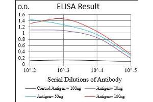 Black line: Control Antigen (100 ng), Purple line: Antigen(10 ng), Blue line: Antigen (50 ng), Red line: Antigen (100 ng), (CTNNBL1 抗体  (AA 390-557))
