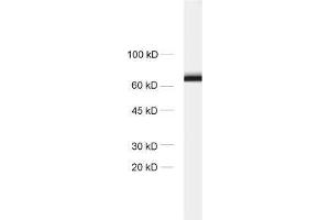 dilution: 1 : 1000, sample: crude synaptosomal fraction of rat brain (P2) (STXBP1 抗体)